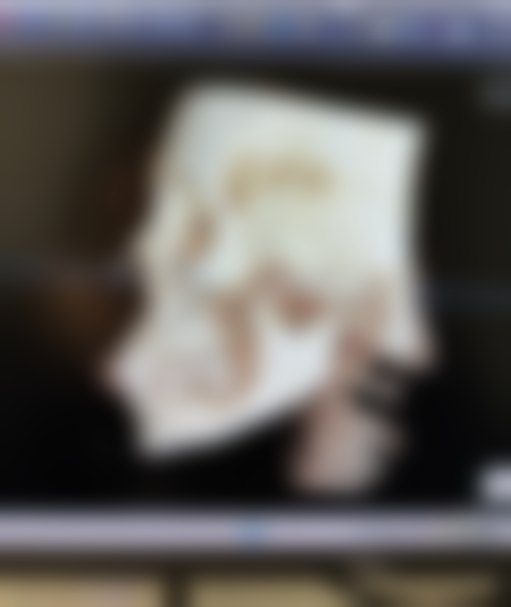 鼻子小也能隆鼻？多种方案助你实现自然协调美鼻，塑造立体五官不是梦 