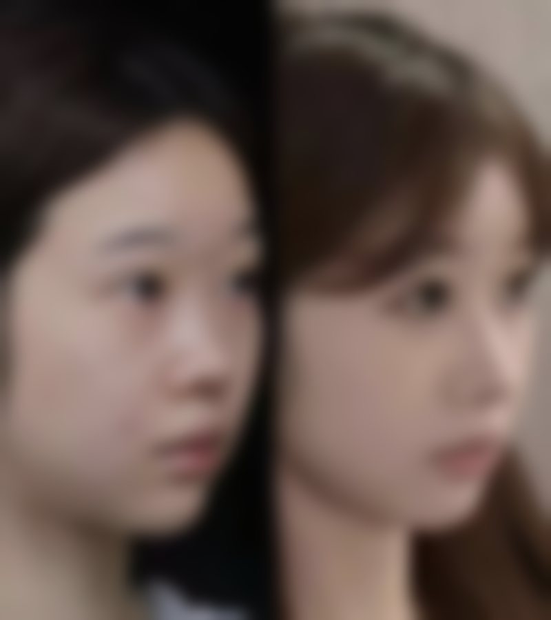 七、六安伊而美医疗美容门诊部真实的顾客评价如下：