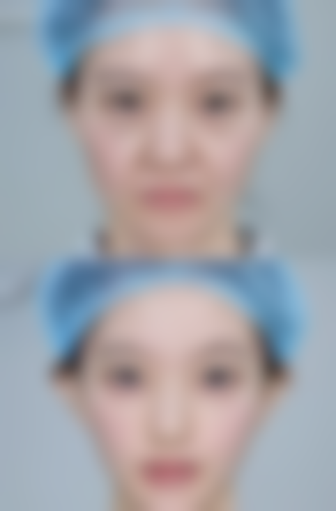 王玄宇眼部整形水平怎么样可靠吗？