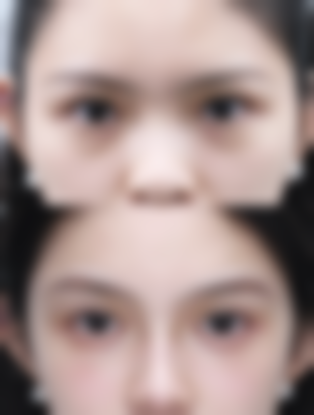 五、大理吴氏嘉美医疗美容实例