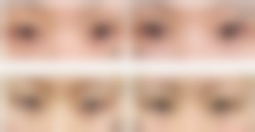 王珮蓉热玛吉实例