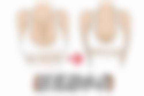 五、哈尔滨双燕整形医院实例