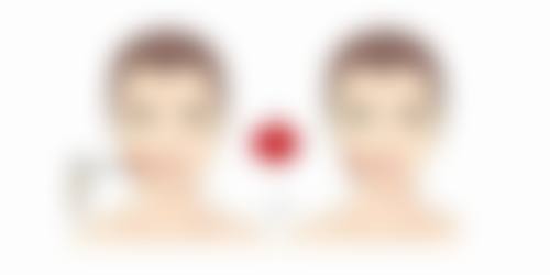 烧伤疤痕修复成效究竟如何？不同医院的特色治疗方案