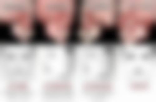 激光/射频类治疗：辅助改善轻度眼袋