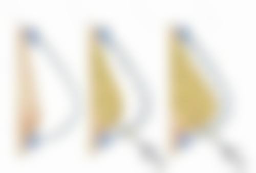 四、医院项目价格体系