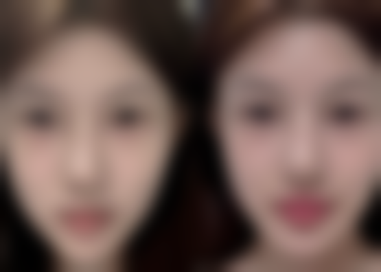 烫伤疤痕治疗要注意啥？这些细节别放过