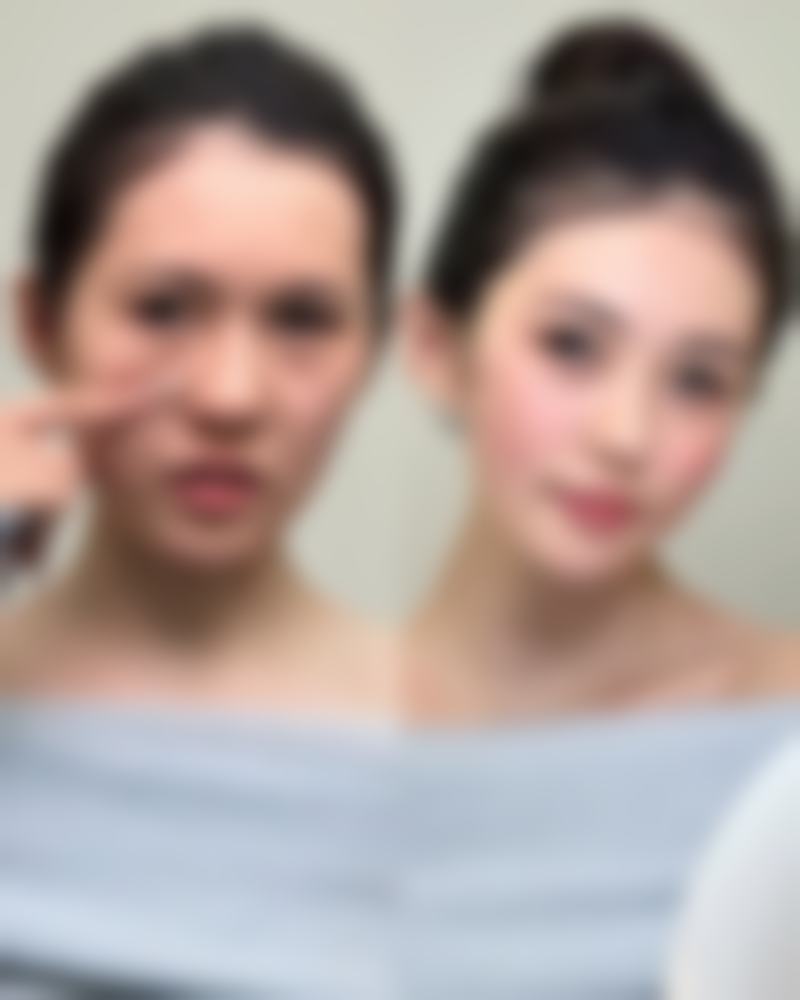 四、合肥新地整形医院实例