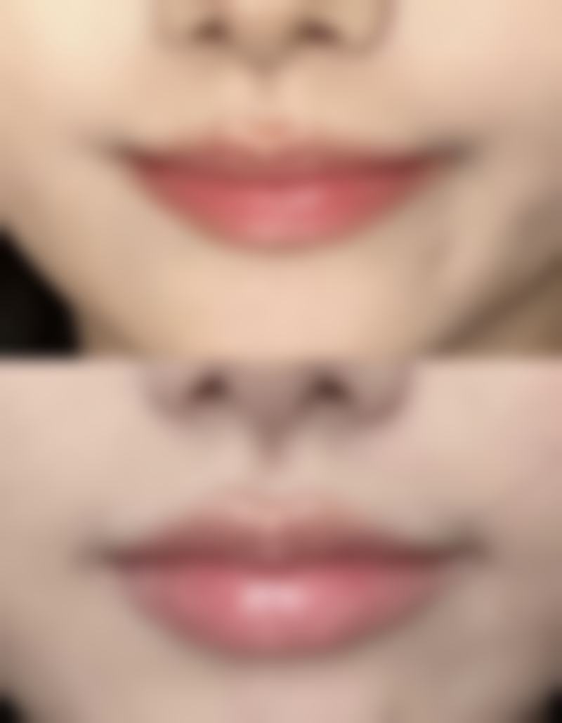 选择哪种隆鼻方式比较好？综合优缺点、适用人群，为你选出理想隆鼻方案！ 