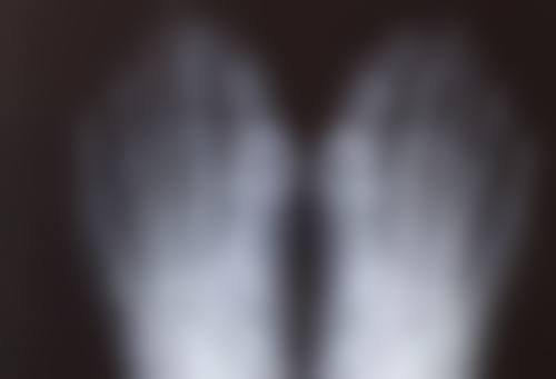 影响修复的因素及护理建议：3 - 6个月稳定，护理助力修复