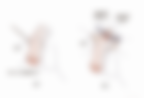 割双眼皮前,心理建设要加强!理性看待美丽蜕变