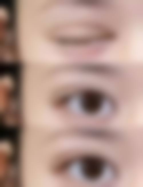 李长赋眼部整形水平怎么样可靠吗？