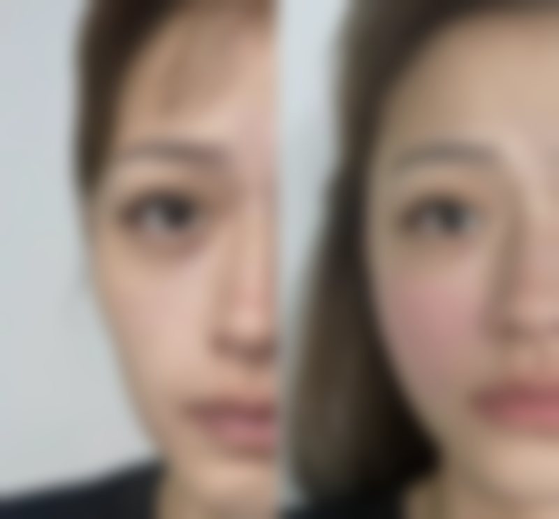 六、哈尔滨诺嬄美医疗美容门诊部价格表:(仅供参考)