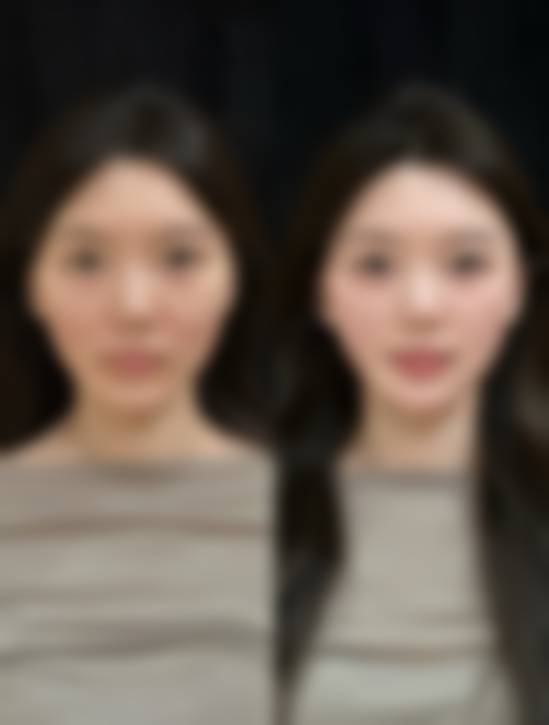 六、大同同美汇医疗美容诊所怎么预约: