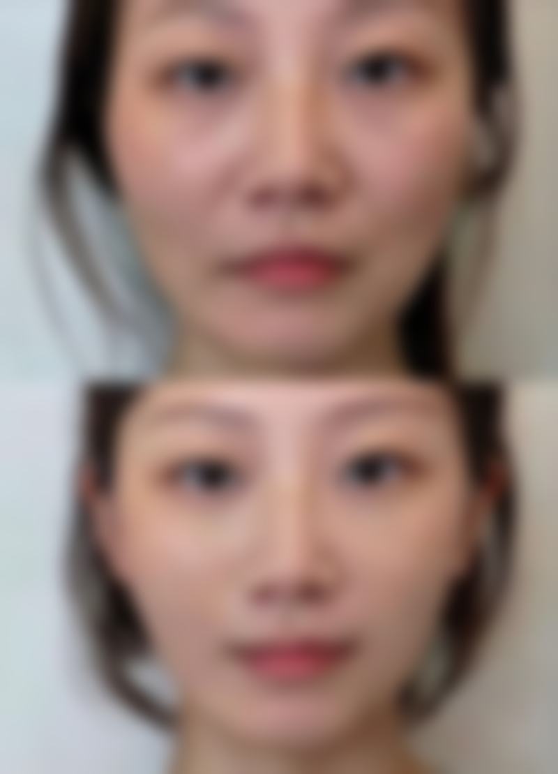 七、毕节博丽医疗整形美容诊所价格表：（仅供参考）