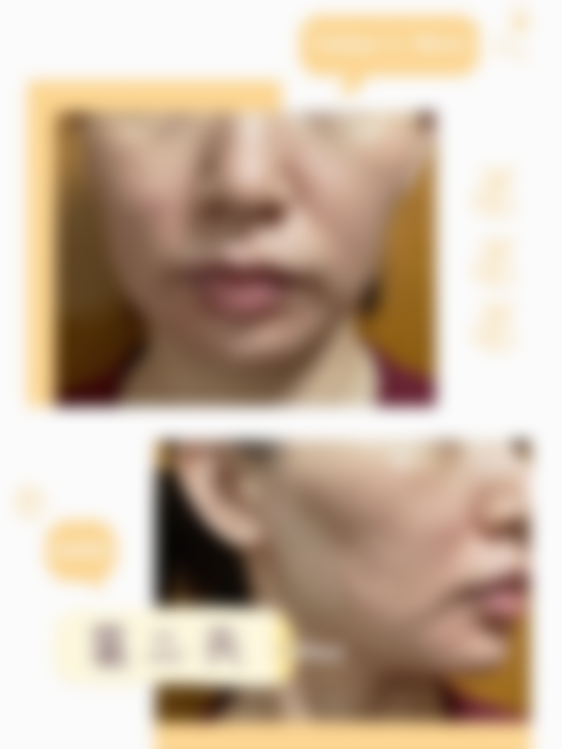 半岛超声炮的成效展现