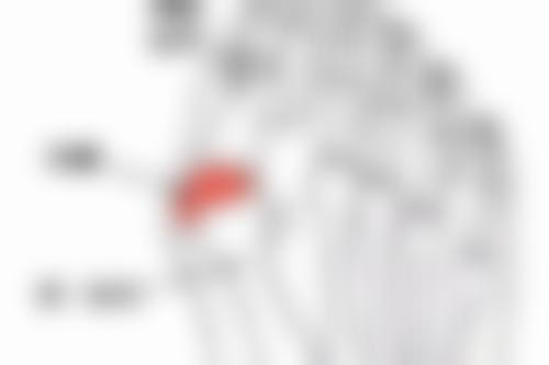 隆胸术后能否独自休养？取决于手术方式和个人情况