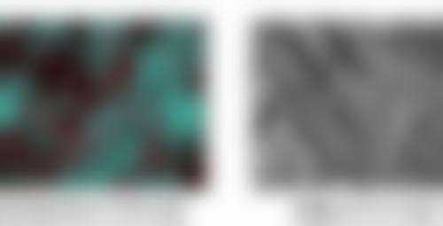 隆胸手术属于大手术？深度剖析其规模、风险及正规医院优势与特色