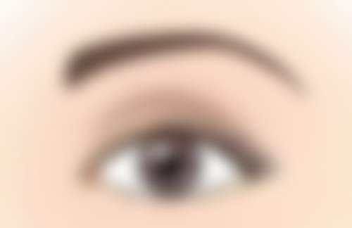 怎样在术后护理去眼袋，巩固成效不反弹？