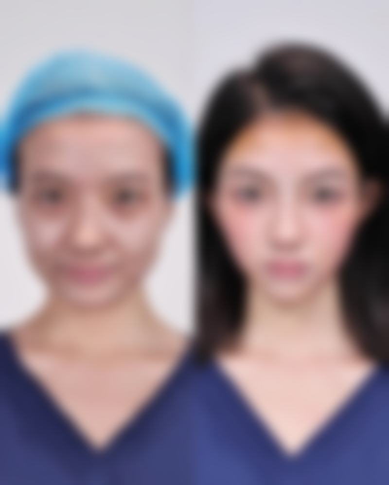 七、广州昊妍整形医院价格表：（仅供参考）