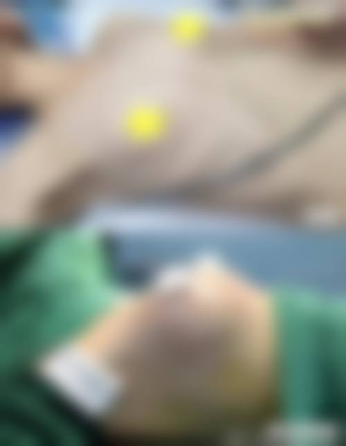 宋晓萍面部轮廓整形水平怎么样可靠吗?