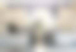 张凤余玻尿酸填充水平怎么样可靠吗？