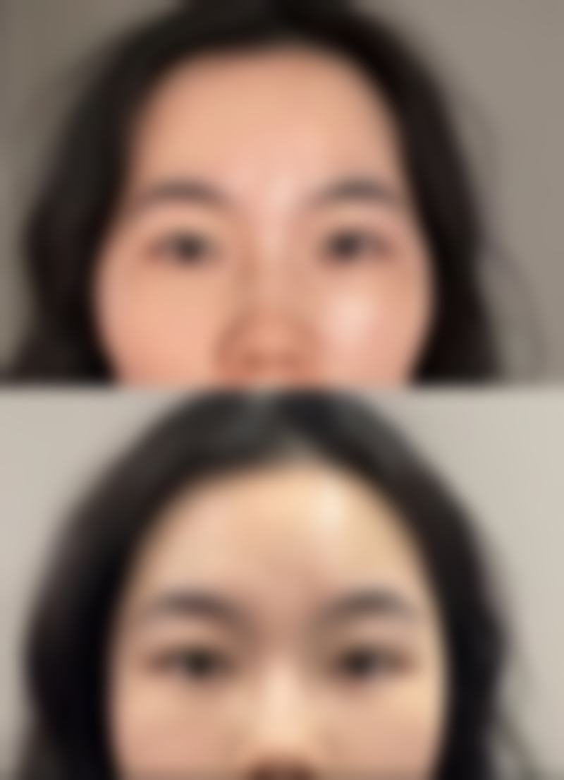 四、韩国世贤整形外科医院实例