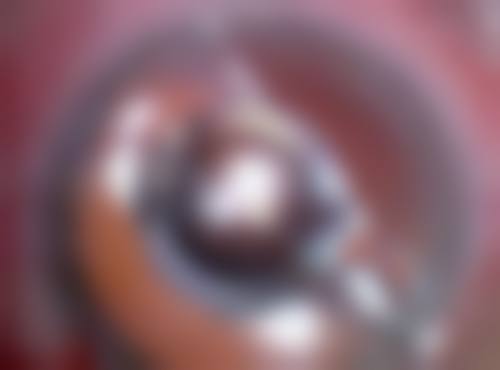 四、临汾皮肤病医院皮肤美容科实例