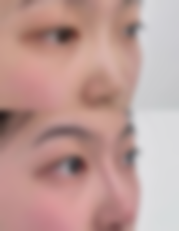 得疤痕疙瘩怎么治疗？选疤康医院准没错