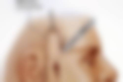 四、宁夏西 京医院医学美容整形科实例