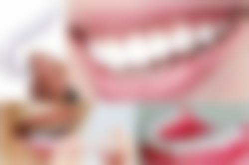 海口爱牙口腔医院矫正牙齿成效咋样？个性化方案定制