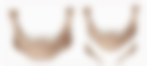 田刚肝脏切除水平怎么样可靠吗？