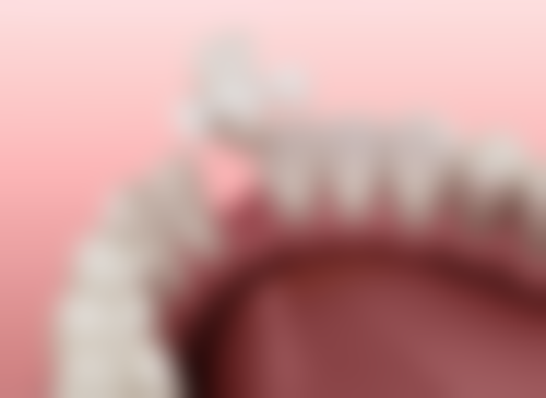 海口爱牙口腔医院矫正牙齿成效咋样？精良技术助力