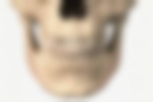 抽脂瘦大腿安心吗？医生技术是保护