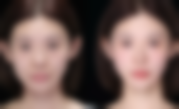 术后护理不可少，修复成效更理想