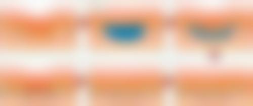 380元特价瘦脸针敢不敢打？正规机构优质产品，让你安全拥有精致小脸！ 