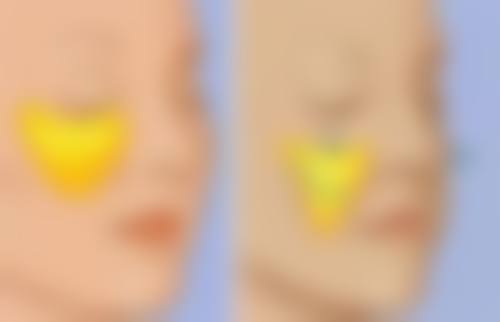 真有能去眼袋的眼霜！精细匹配肤质选眼霜