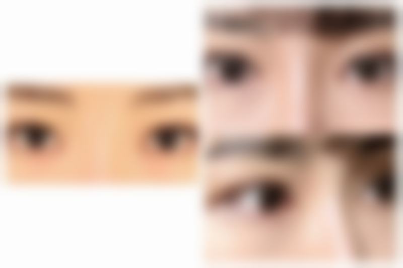 正规机构的保护，让你放心打瘦脸针