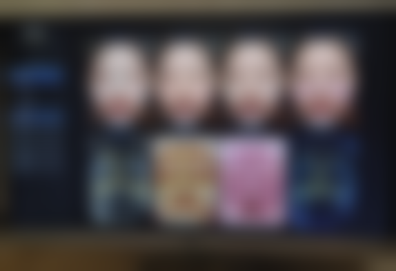 混油敏皮亲测！北京圣嘉新杏枝山1680元，术后无痛水润续5次