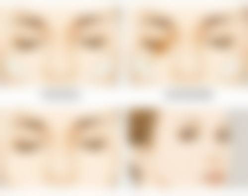 六、章丘奥维丽医疗美容诊所价格表：（仅供参考）