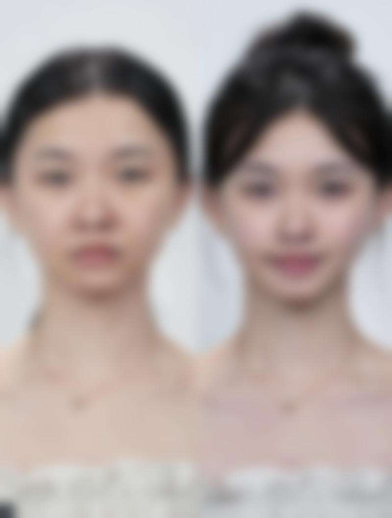 四、青岛瑧妍美医疗美容医院的口碑与优势