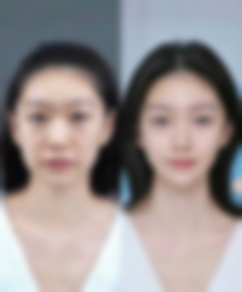 五、西宁市非常好人民医院整形美容科怎么预约：