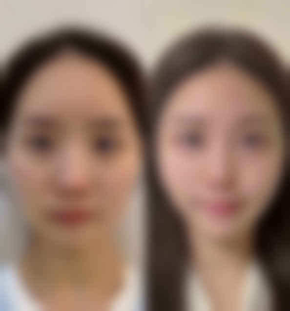 五、许昌华姿医美整形医院怎么预约：