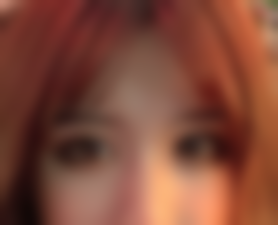 大小眼别再焦虑啦！重庆松山医美兰宇眼综合6800元术后一月双眼对称