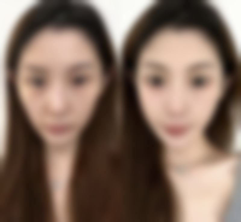 张小丽医生口碑和评价