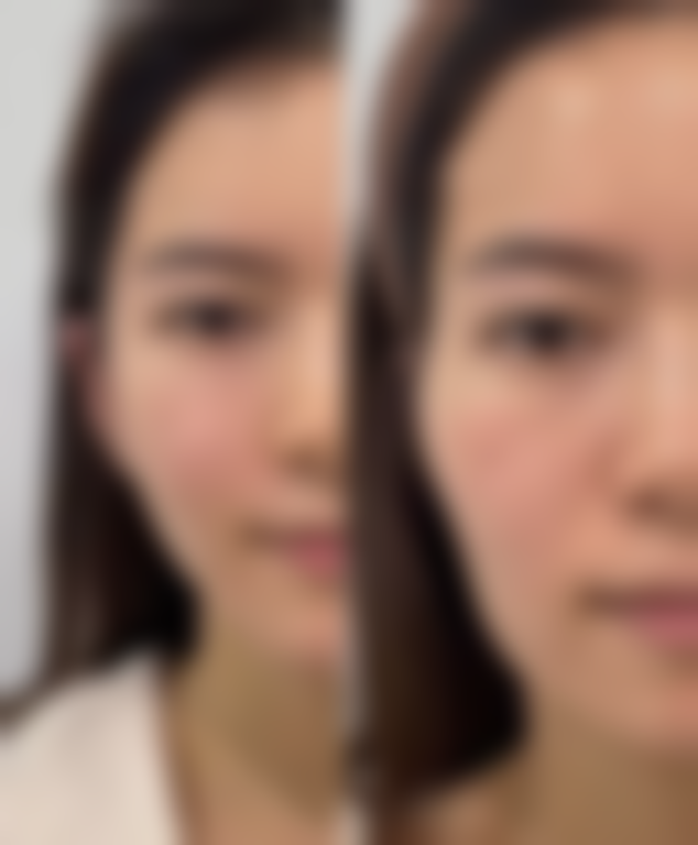 四、西安漾思医疗美容诊所开展的主要项目和特色项目