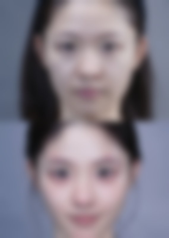 八、西安漾思医疗美容诊所真实的顾客评价如下：