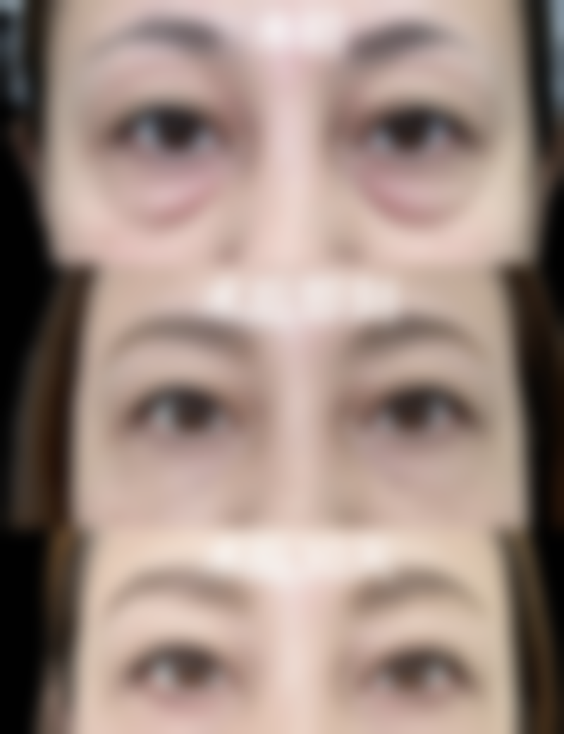 张小丽医生治疗牙体牙髓疾病实例