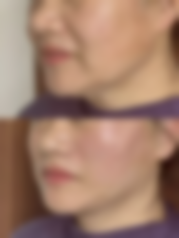 七、景德镇艺美整形医疗美容门诊部价格表：（仅供参考）