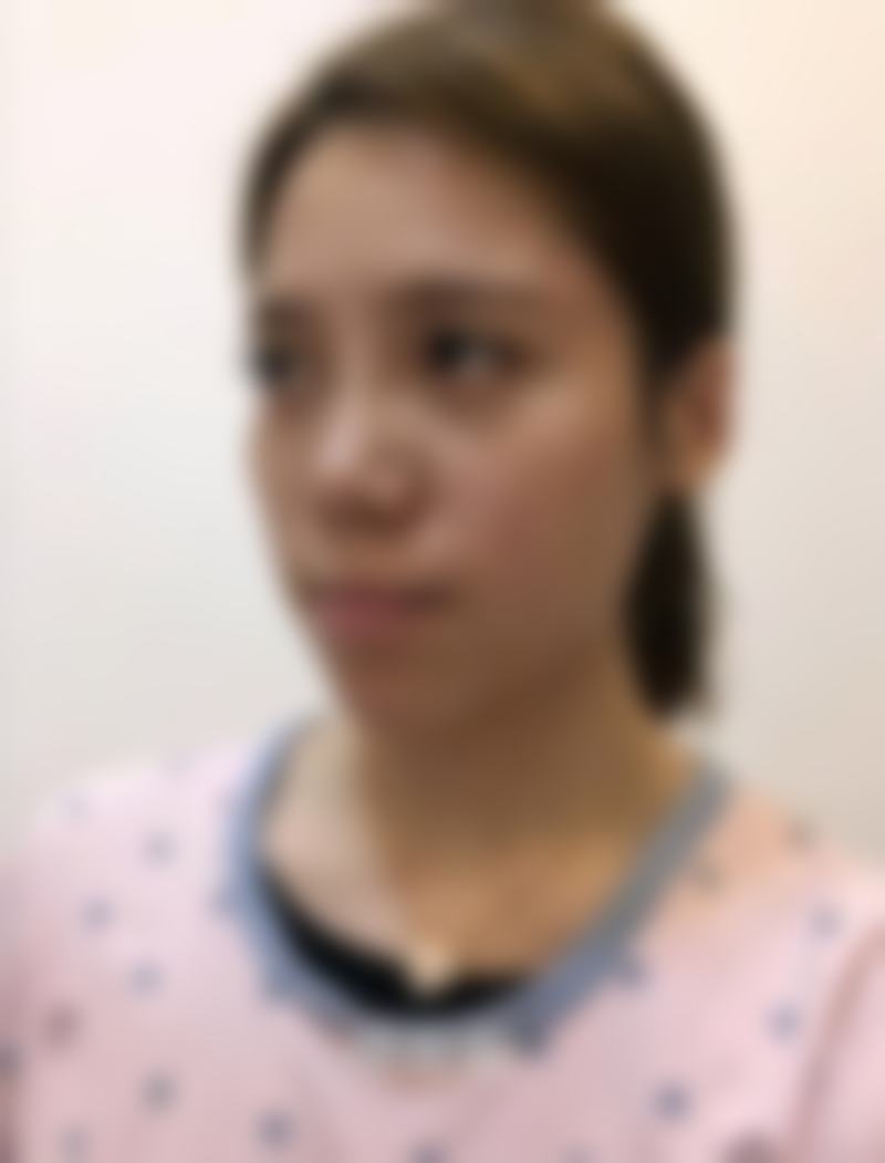 现在的成效真的绝了！再也不用当“阴影侠”