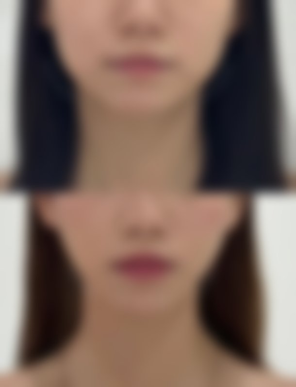 五、日照懿后唐美人医疗美容诊所怎么预约：